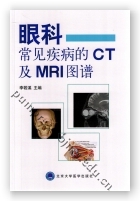 眼科常见疾病的CT及MRI图谱