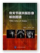 骨关节磁共振影像解剖图谱