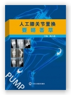 人工膝关节置换要略荟萃