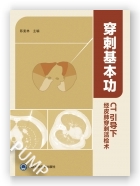 穿刺基本功-CT引导下经皮肺穿刺活检术